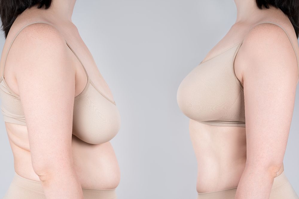 Meme Dikleştirme Estetiği görseli